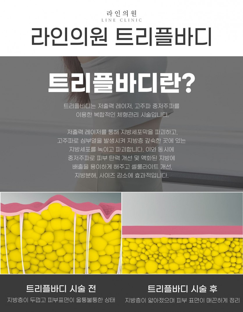 일산, 화정, 고양시, 피부과, 성형외과, 트리플바디, 트리플바디피부과, 다이어트시술, 다이어트관리, 화정역, 백석, 마두, 원당, 능곡, 행신동, 운정, 파주, 김포