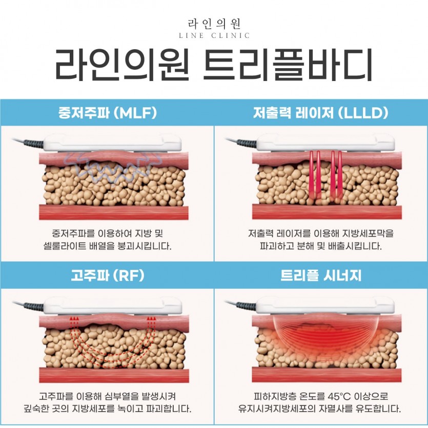 일산, 화정, 고양시, 피부과, 성형외과, 트리플바디, 트리플바디피부과, 다이어트시술, 다이어트관리, 화정역, 백석, 마두, 원당, 능곡, 행신동, 운정, 파주, 김포